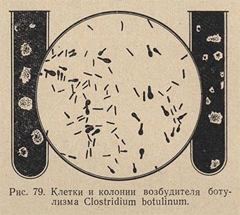 Клетки и колонии возбудителя ботулизма