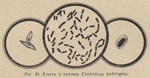 Клетки и колонии Clostridium perfringens