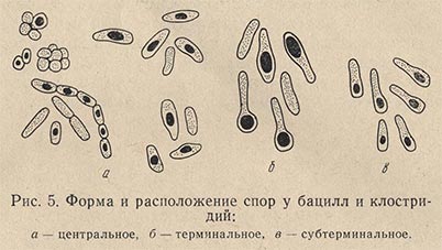 Форма и расположение спор у бацилл и клостридий