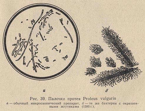 Палочка протея (Proteus vulgaris)
